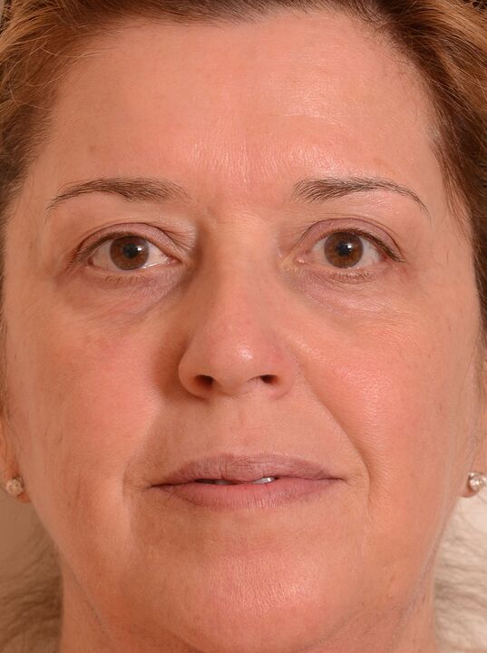 Ich habe mein Gesicht mit der Eudalie -Creme verjüngt