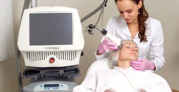 Die Prozedur durchführen