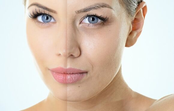 Indikationen für die fraktionale Verjüngung