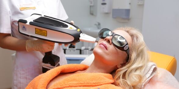 Lifting nach dreißig Jahren